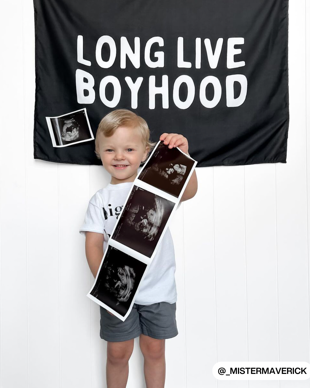 Long Live Boyhood Banner (Black)